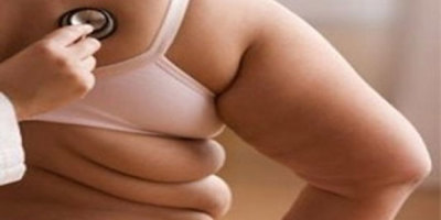 obesidad