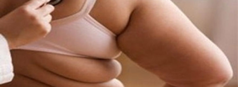 obesidad