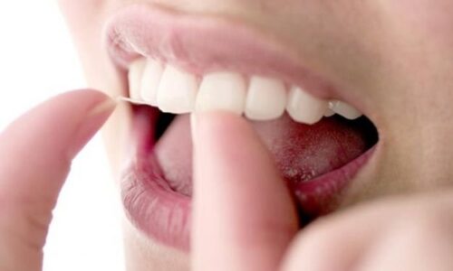 higiene-dental