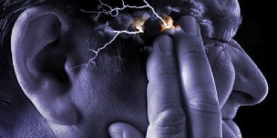 30212152746_migraine_supraorbital_transcutaneous_stimulator_304x171_sciencephotolibrary