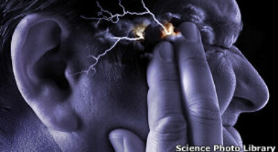 30212152746_migraine_supraorbital_transcutaneous_stimulator_304x171_sciencephotolibrary