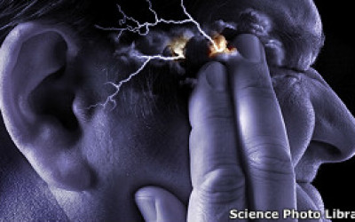 30212152746_migraine_supraorbital_transcutaneous_stimulator_304x171_sciencephotolibrary