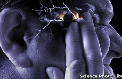 30212152746_migraine_supraorbital_transcutaneous_stimulator_304x171_sciencephotolibrary
