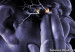 30212152746_migraine_supraorbital_transcutaneous_stimulator_304x171_sciencephotolibrary