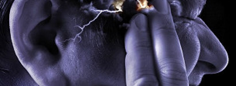 30212152746_migraine_supraorbital_transcutaneous_stimulator_304x171_sciencephotolibrary