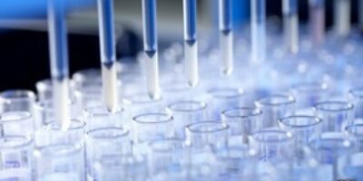 Descubren-cmo-se-propaga-el-virus-de-la-hepatitis-C-300x168