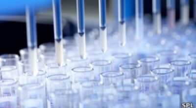 Descubren-cmo-se-propaga-el-virus-de-la-hepatitis-C-300x168