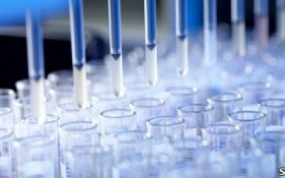 Descubren-cmo-se-propaga-el-virus-de-la-hepatitis-C-300x168