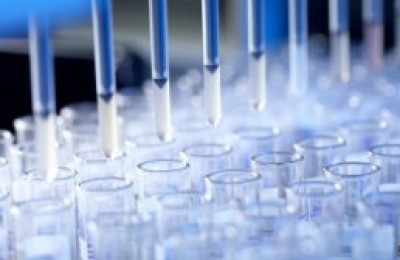 Descubren-cmo-se-propaga-el-virus-de-la-hepatitis-C-300x168