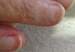 UNAS_Y_ENFERMEDADES