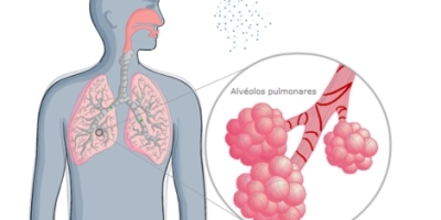 tubercuilosis2435658690