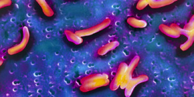 130228124855_colera_bacteria_304x171_spl
