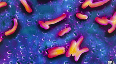 130228124855_colera_bacteria_304x171_spl