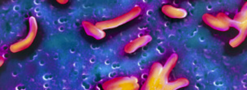 130228124855_colera_bacteria_304x171_spl