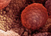 130304113701_prostata_304x171_spl