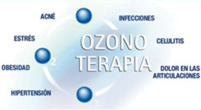 Ozonoterapia
