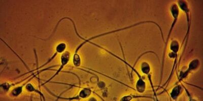 semen657u