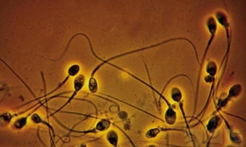 semen657u