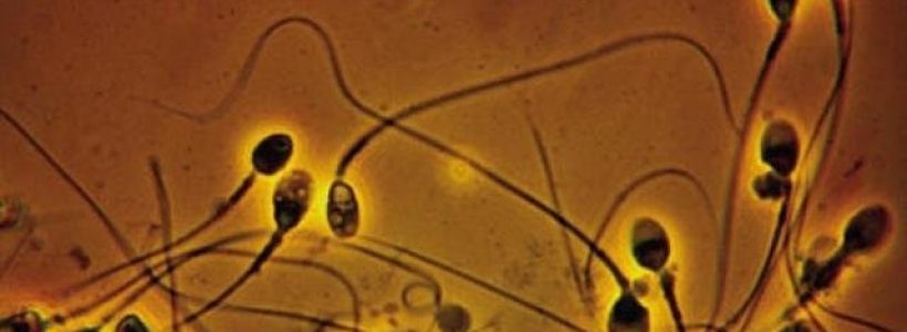 semen657u