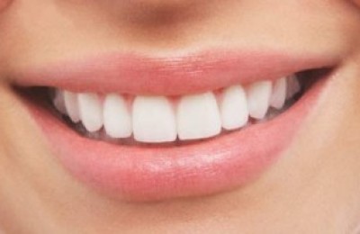 Dientes-blancos--300x192