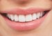 Dientes-blancos--300x192