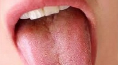 boca-lengua-300x192