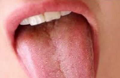 boca-lengua-300x192