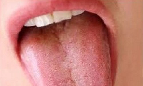 boca-lengua-300x192