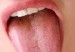 boca-lengua-300x192