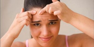 eliminar-el-acne-10puntos