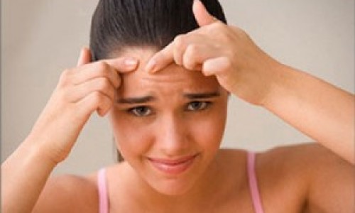 eliminar-el-acne-10puntos