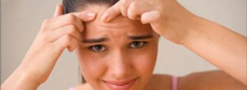 eliminar-el-acne-10puntos