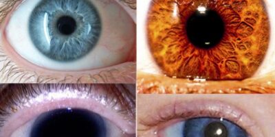 ojos2jhbjkhgh