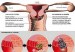 cancer-oral-300x241