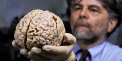 cerebro-humano-300x200