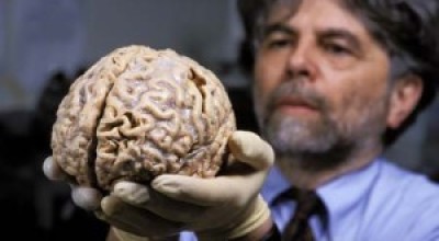 cerebro-humano-300x200