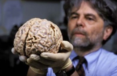 cerebro-humano-300x200