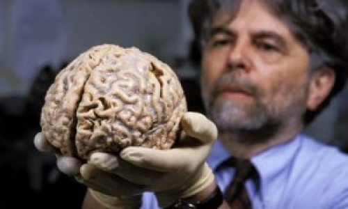 cerebro-humano-300x200