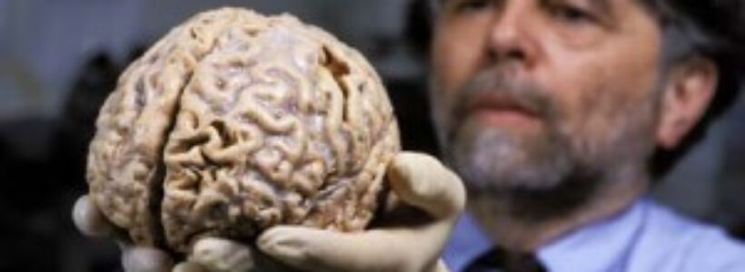 cerebro-humano-300x200
