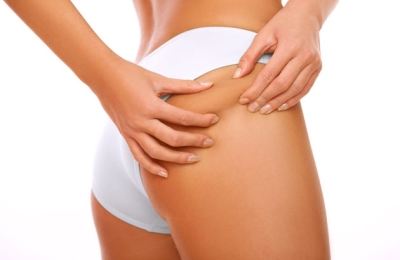 consejos-para-reducir-la-celulitis2