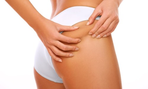 consejos-para-reducir-la-celulitis2
