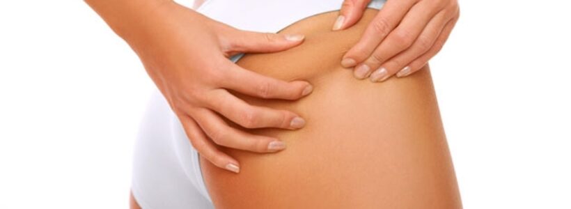 consejos-para-reducir-la-celulitis2