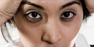 ojeras_2