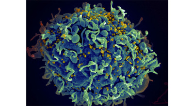 HIV_AIDS