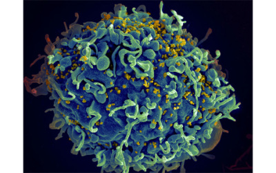HIV_AIDS