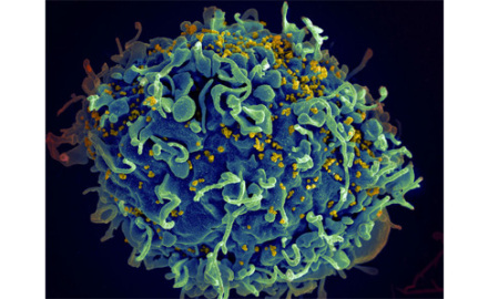 HIV_AIDS