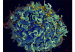 HIV_AIDS