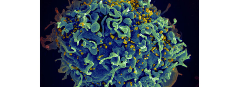 HIV_AIDS