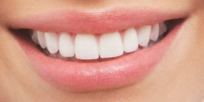sonrisa_4
