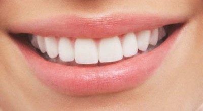 sonrisa_4